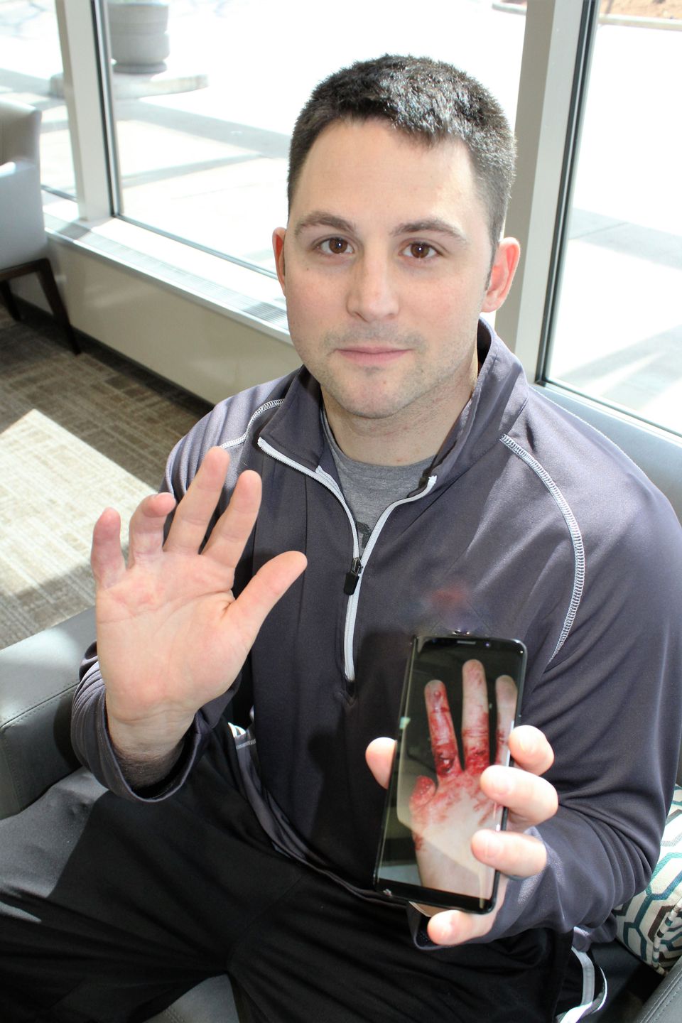Andy Loomis was able to use his hand again following a visit to the Hand Center of St. Catherine Hospital and months of therapy.